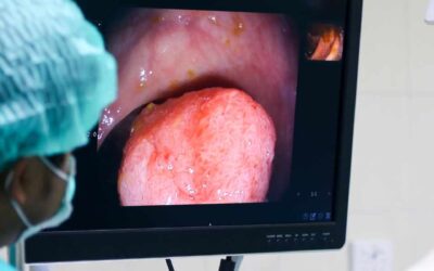 Componentes Clave del Endoscopio: Cómo Su Funcionamiento Afecta la Calidad y la Precisión Médica